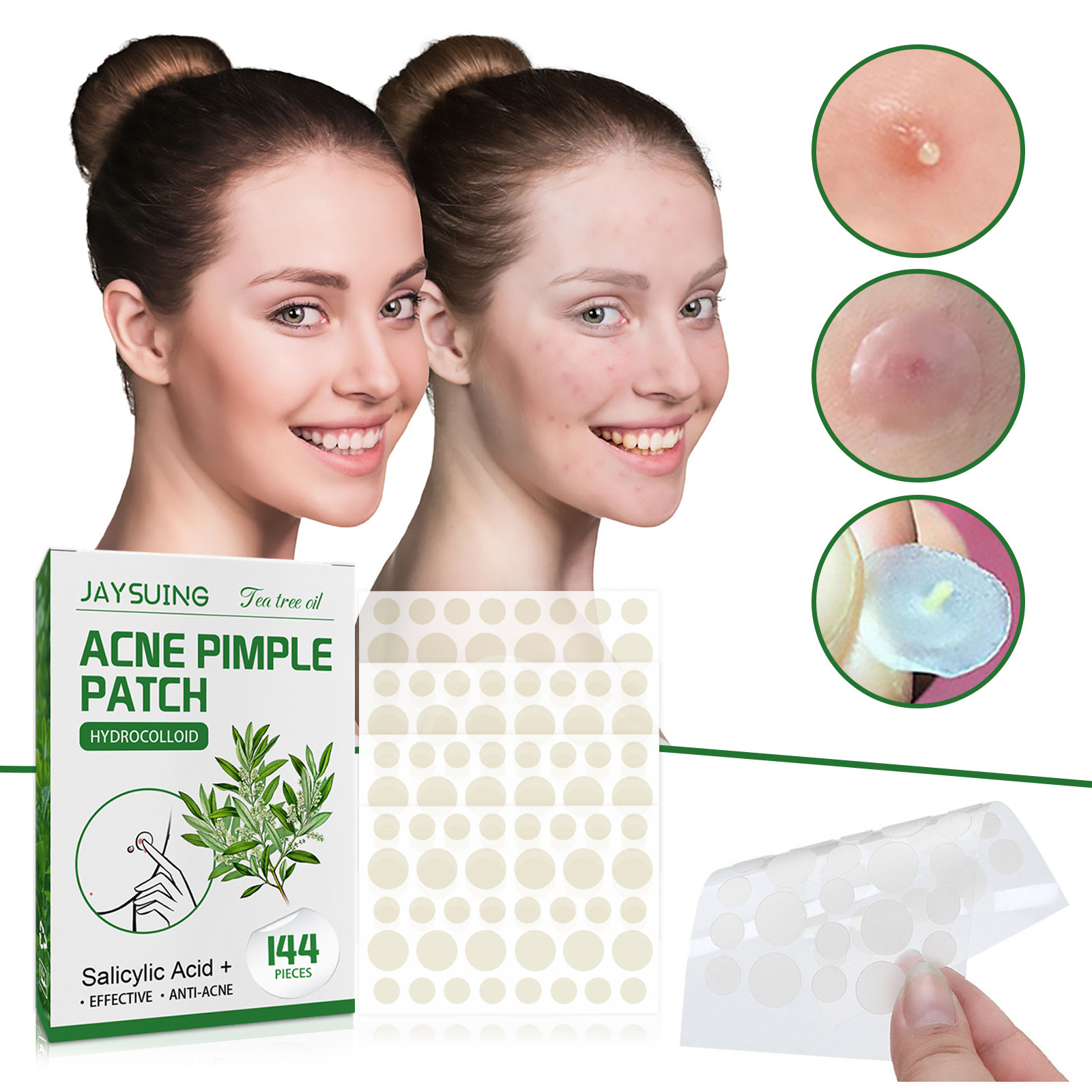 Parches hidrocoloides para el  - Hydrocolloid Pimple Patch reseña y precio